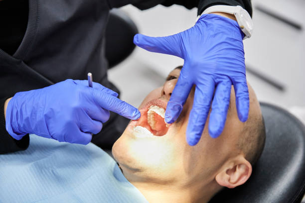 Best Emergency Wisdom Tooth Extraction in Baileyton, AL